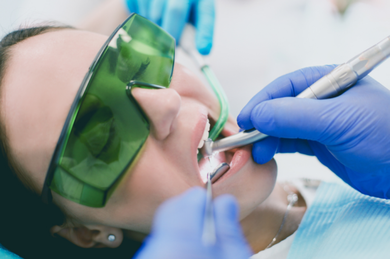 How Do Dentists Seal Teeth?