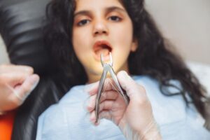 how-much-time-is-needed-to-recuperate-after-a-dental-extraction