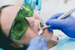 how do dentists seal teeth